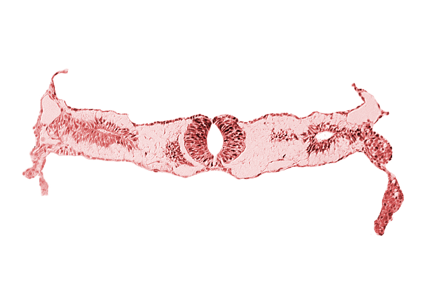 cephalic edge of neural tube, cephalic edge of somite 3 (O-3), fusing neural folds [rhombencephalon (Rh. D)], midgut, primordial peritoneal cavity, surface ectoderm
