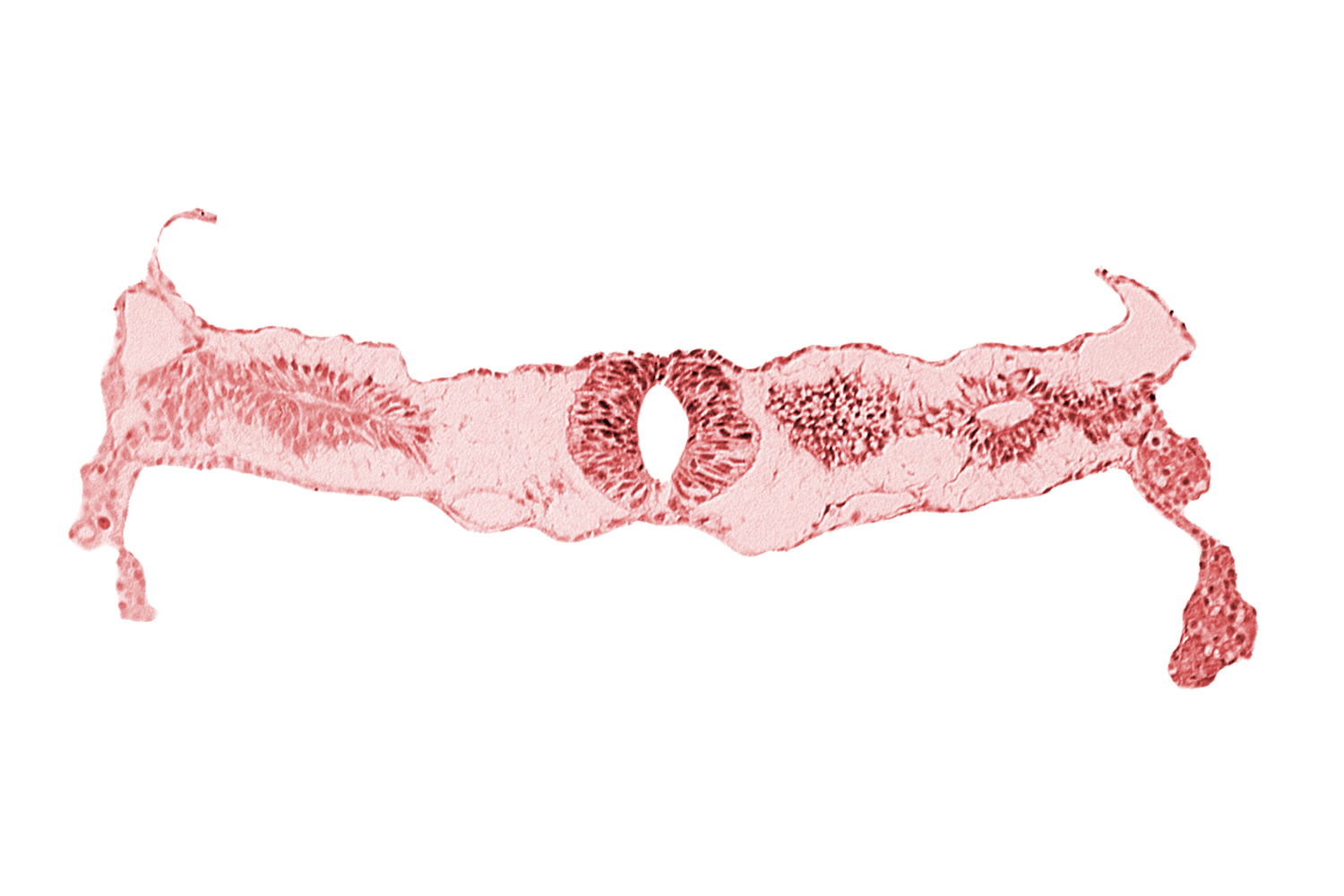 cephalic edge of neural tube, cephalic edge of somite 3 (O-3), fusing neural folds [rhombencephalon (Rh. D)], midgut, primordial peritoneal cavity, surface ectoderm