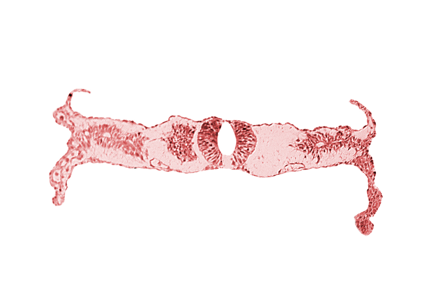 caudal edge of neural tube (junction of brain and spinal cord), fusing neural folds, primordial peritoneal cavity, right umbilical vein, somite 4-5 intersegmental region