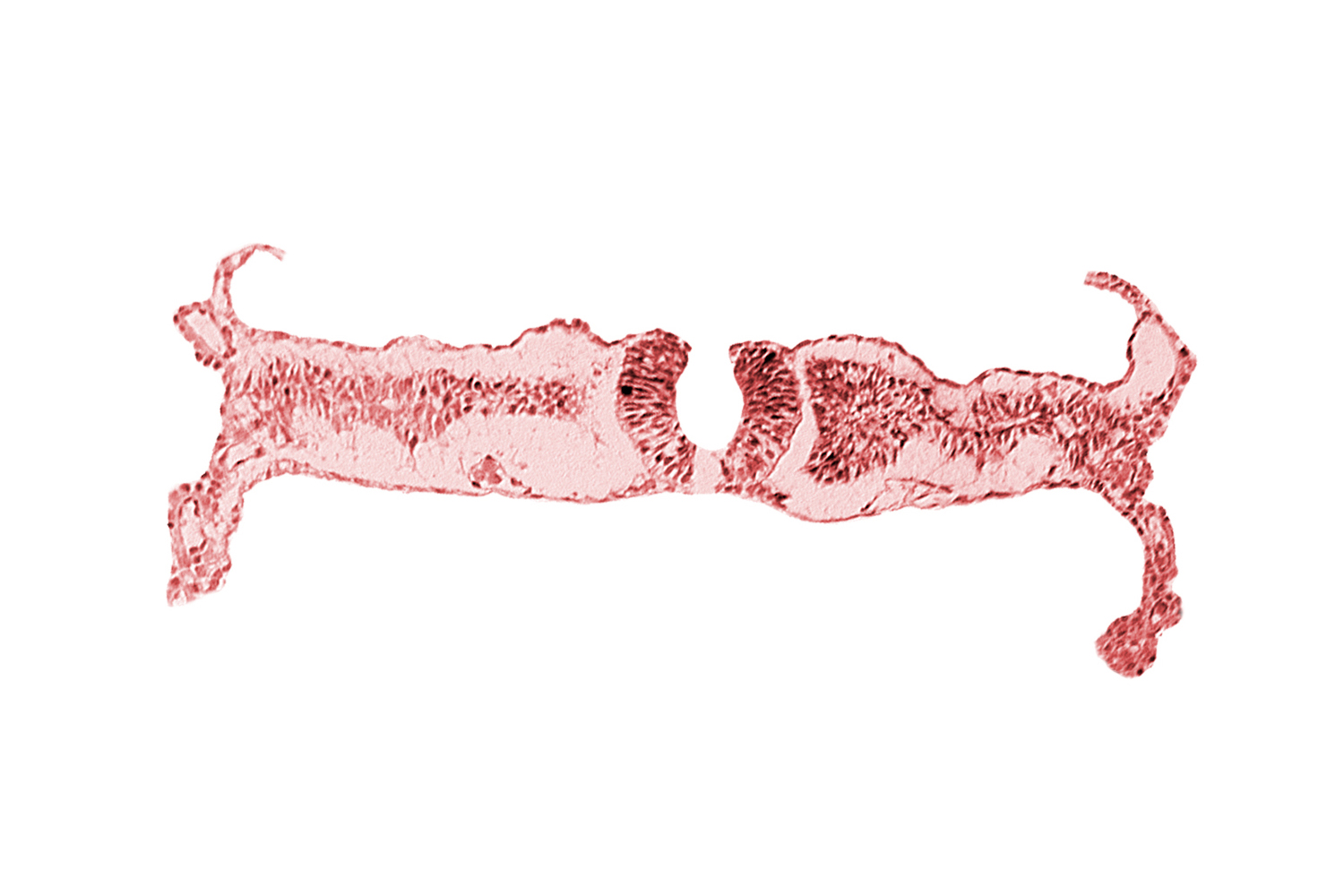 amniotic cavity, artifact separation(s), extra-embryonic coelom, intermediate mesenchyme, midgut, primordial peritoneal cavity, somite 5 (C-1), umbilical vesicle cavity