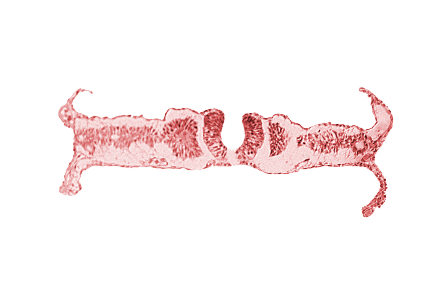 caudal edge of somite 5 (C-1), caudal neuropore, nephrogenic cord