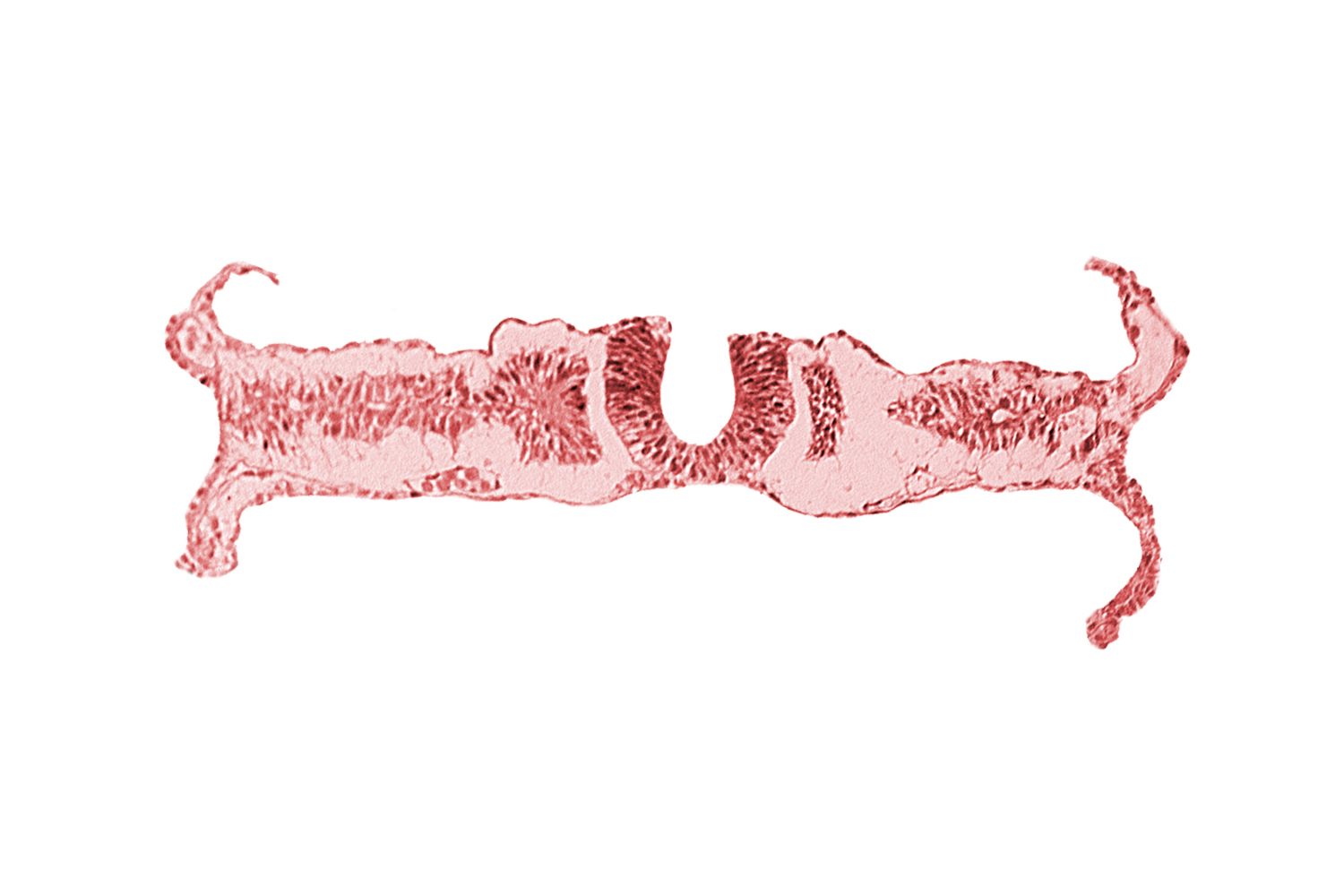 caudal edge of somite 5 (C-1), caudal neuropore, nephrogenic cord, umbilical vesicle wall