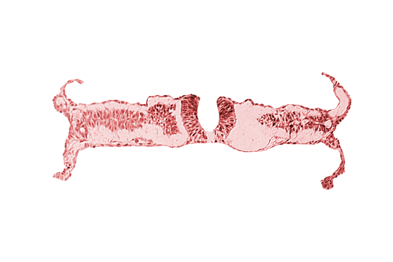 caudal neuropore, somite 5-6 intersegmental region