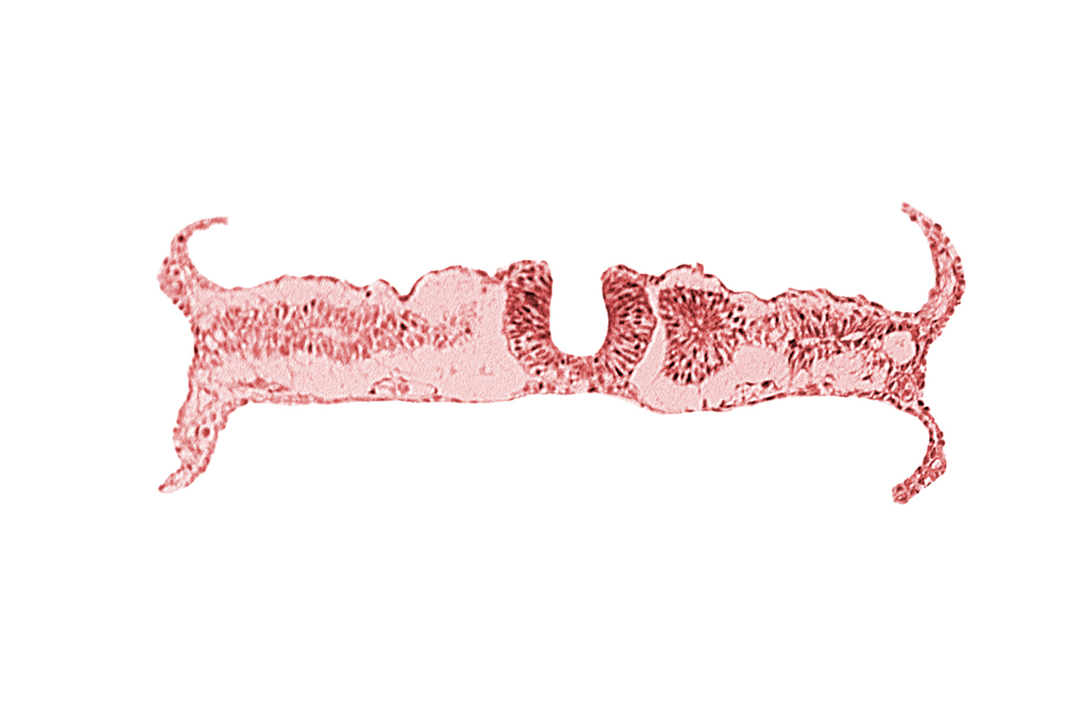 amnion attachment, amniotic cavity, caudal neuropore, dorsal aorta, extra-embryonic coelom, midgut, nephrogenic cord, right umbilical vein, somite 6 (C-2), somitocoel 6, umbilical vesicle cavity, umbilical vesicle wall