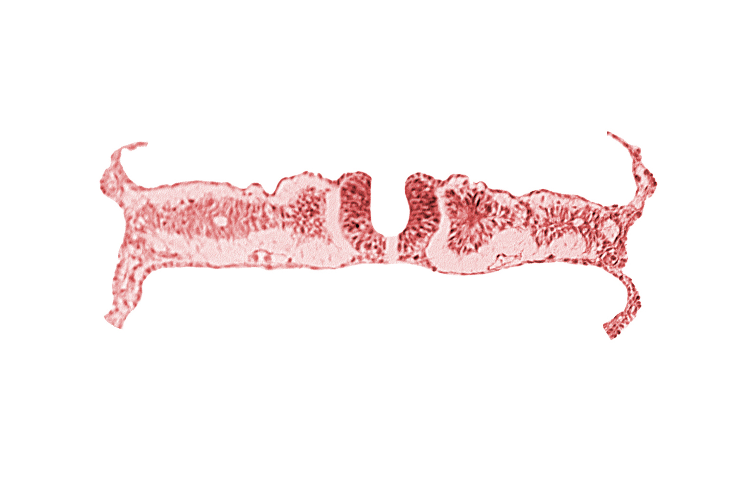 amnion attachment, amniotic cavity, caudal neuropore, dorsal aorta, extra-embryonic coelom, midgut, nephrogenic cord, right umbilical vein, somite 6 (C-2), somitocoel 6, umbilical vesicle cavity, umbilical vesicle wall