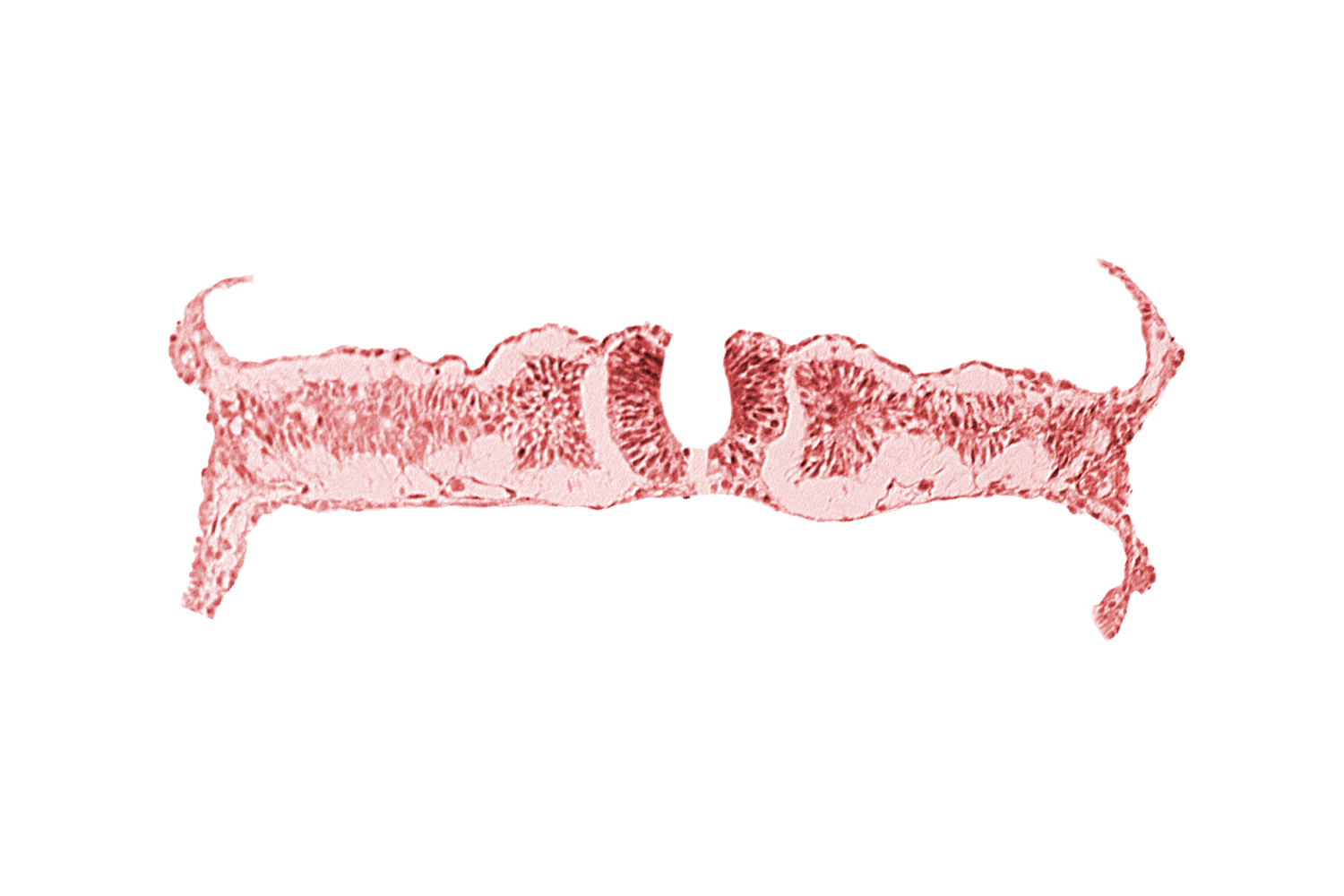 amnion attachment, amniotic cavity, caudal neuropore, dorsal aorta, extra-embryonic coelom, midgut, nephrogenic cord, right umbilical vein, somite 6 (C-2), somitocoel 6, umbilical vesicle cavity, umbilical vesicle wall
