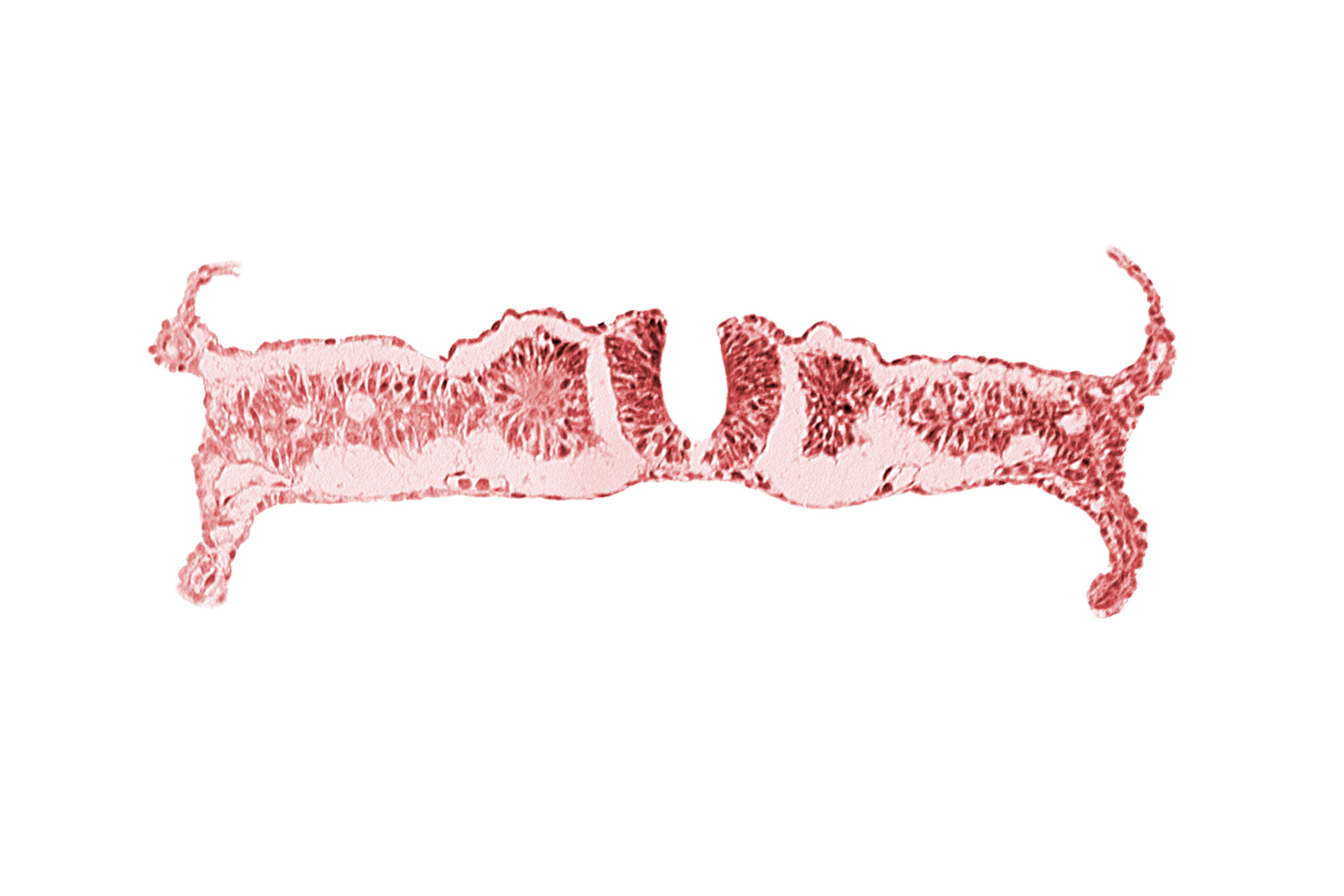 amnion, nephrogenic cord, notochordal plate, primordial peritoneal cavity, right umbilical vein, somite 6 (C-2), umbilical vesicle wall