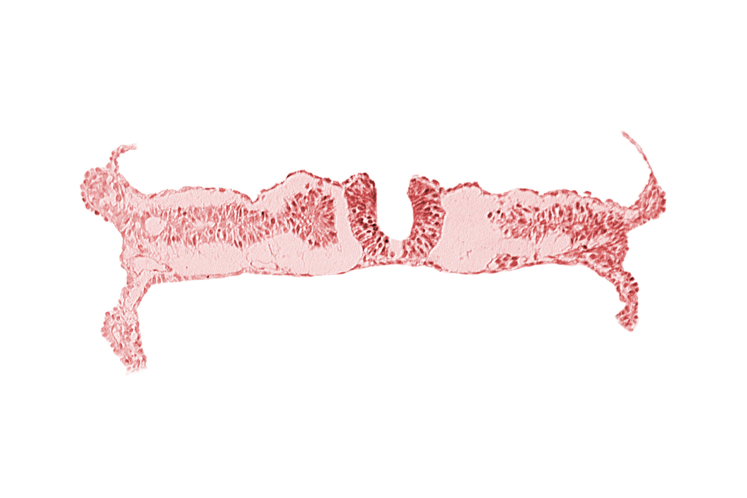 embryonic endoderm, embryonic surface ectoderm, right umbilical vein, somite 6-7 intersegmental region, umbilical vesicle wall endoderm, umbilical vesicle wall mesoderm