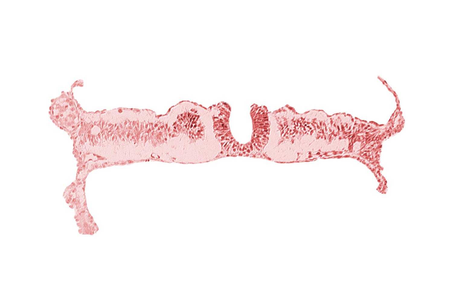 dorsal aorta, junction of neural ectoderm and surface ectoderm, lateral plate mesoderm, nephrogenic cord, neural fold, neural groove, notochordal plate, somite 7 (C-3), umbilical vesicle wall endoderm, umbilical vesicle wall mesoderm