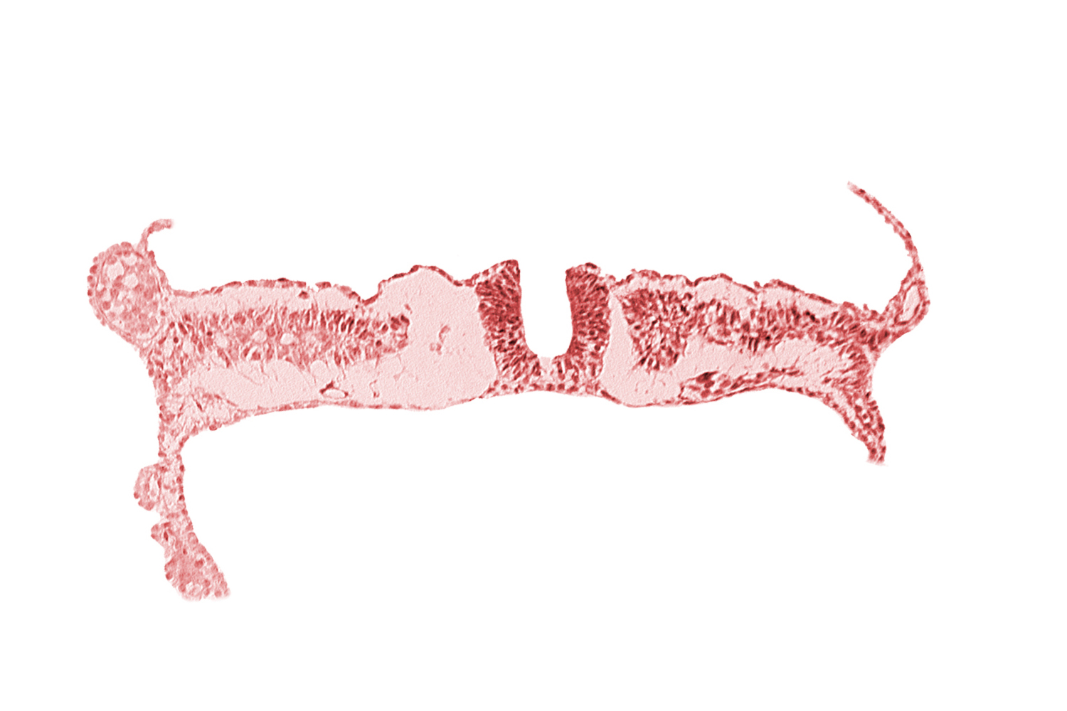 dorsal aorta, junction of neural ectoderm and surface ectoderm, lateral plate mesoderm, nephrogenic cord, neural fold, neural groove, notochordal plate, somite 7 (C-3), umbilical vesicle wall endoderm, umbilical vesicle wall mesoderm