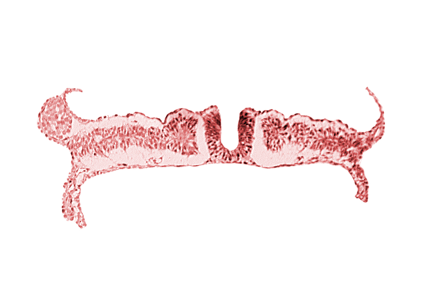 dorsal aorta, nephrogenic cord, somite 7 (C-3)
