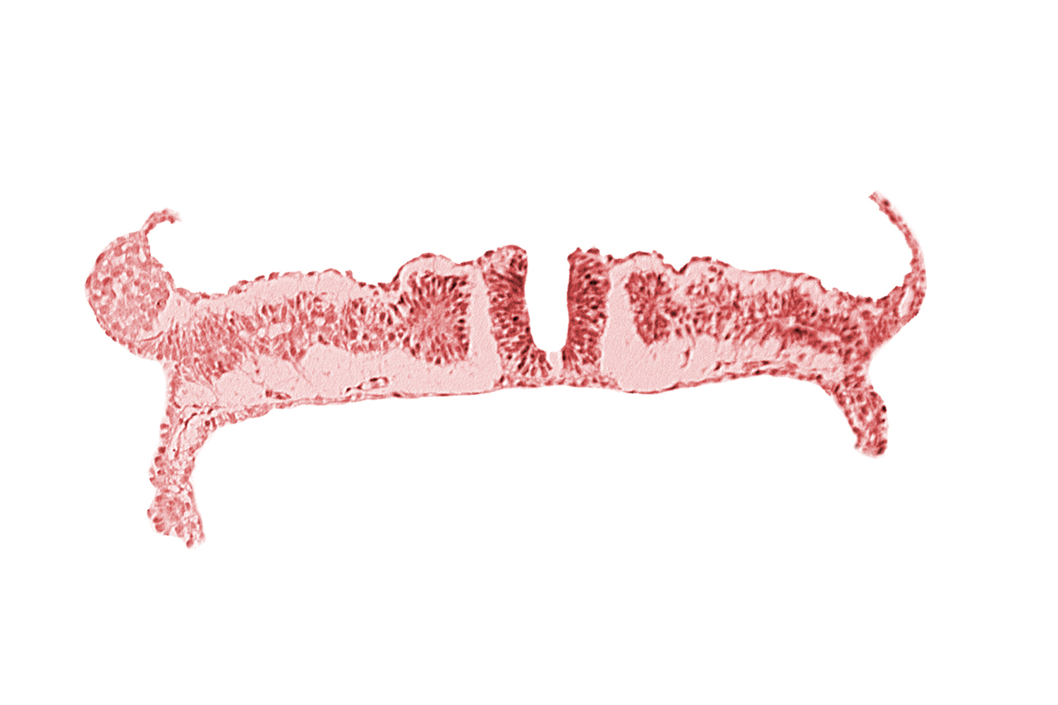 dorsal aorta, nephrogenic cord, somite 7 (C-3)