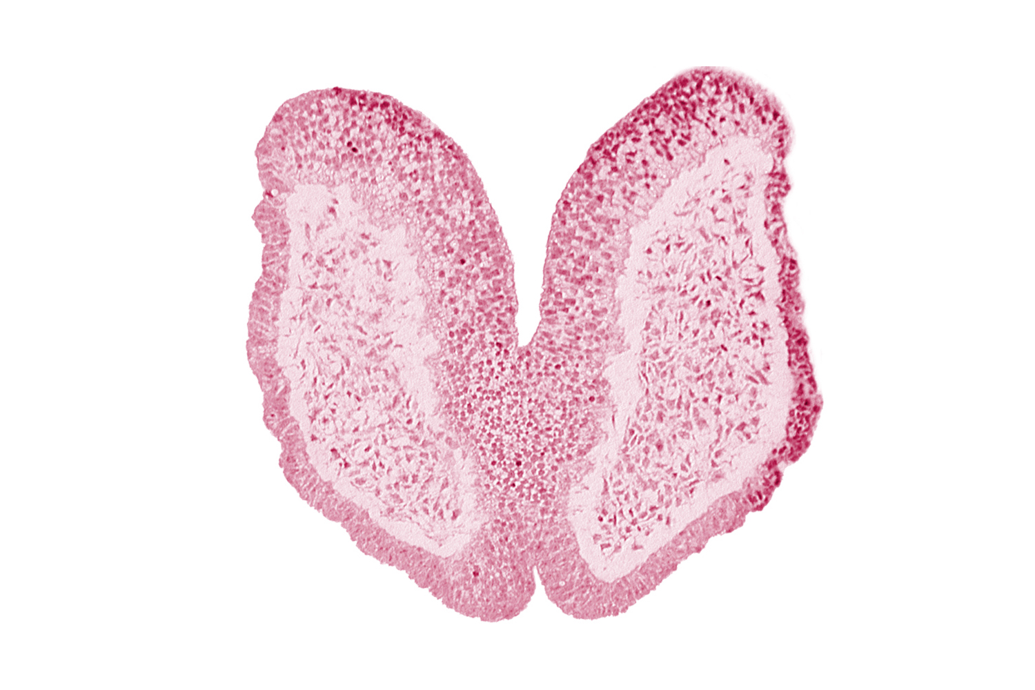 amniotic cavity, artifact space(s), chiasmatic plate (D1), head mesenchyme, junction of neural fold and surface ectoderm, maxillary prominence of pharyngeal arch 1, neural fold [primordial telencephalon medium (T)], surface ectoderm of head, terminal notch