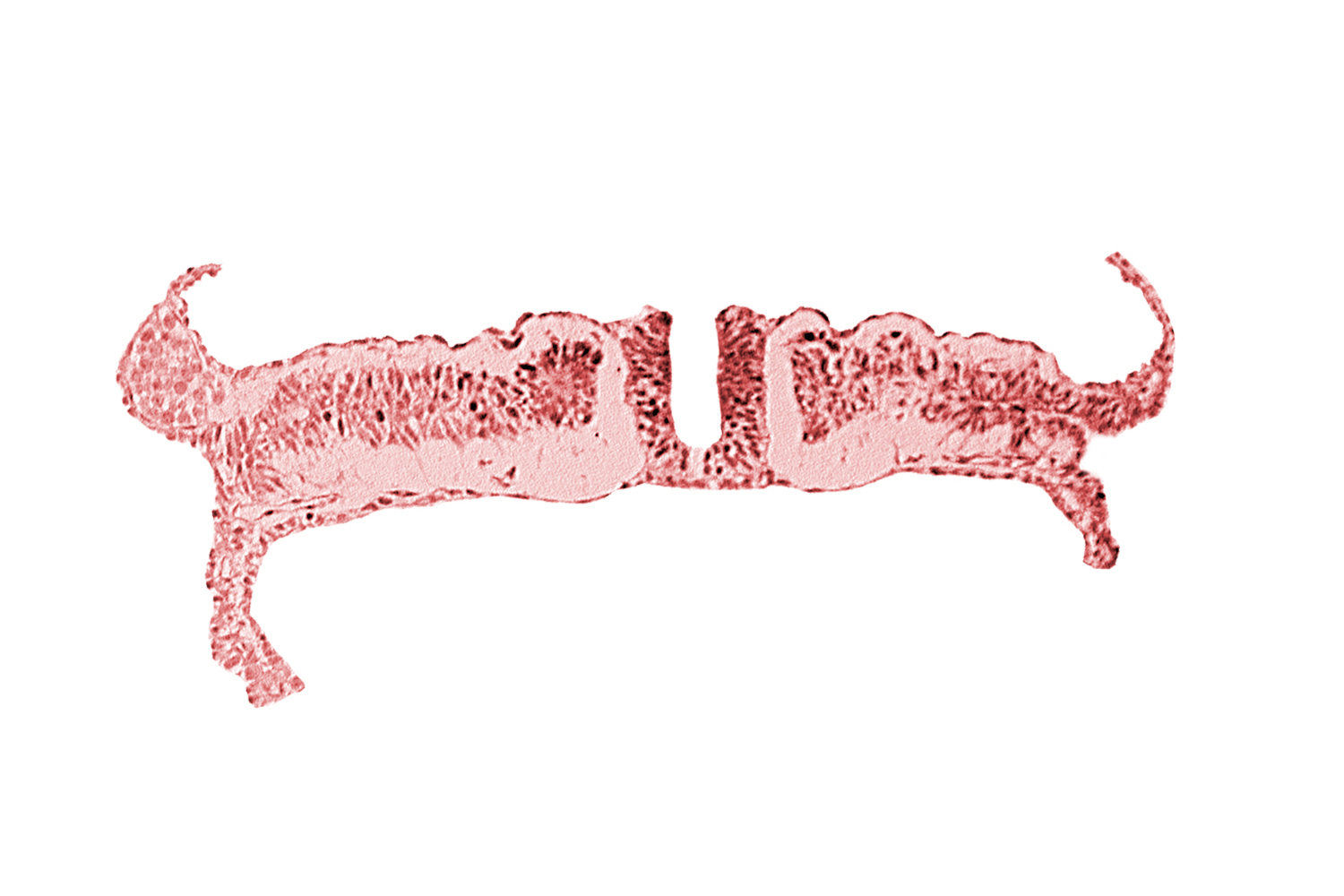 caudal neuropore, intermediate mesenchyme, lateral plate mesoderm, paraxial mesoderm, umbilical vesicle wall endoderm, umbilical vesicle wall mesoderm