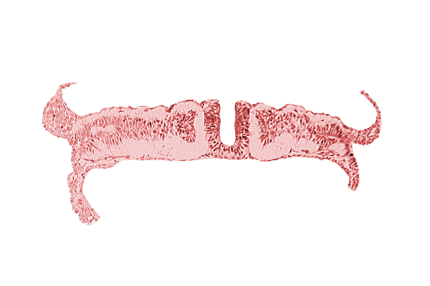 caudal neuropore, intermediate mesenchyme, lateral plate mesoderm, paraxial mesoderm, umbilical vesicle wall endoderm, umbilical vesicle wall mesoderm
