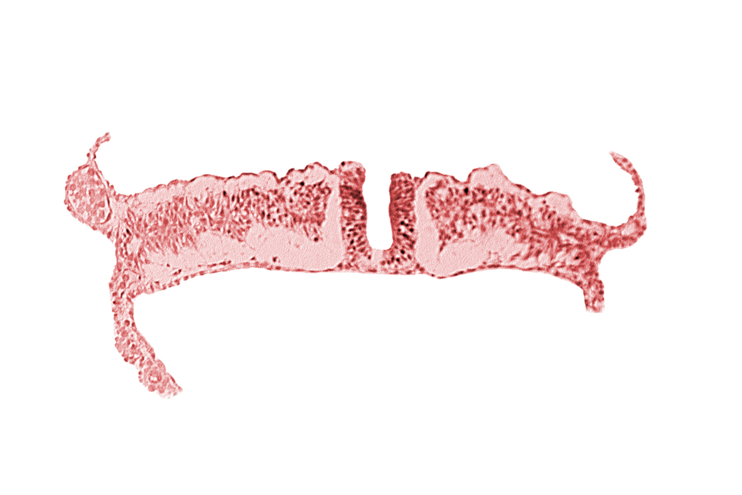 dorsal aorta, embryonic endoderm, embryonic surface ectoderm, extra-embryonic coelom, extra-embryonic ectoderm, extra-embryonic endoderm, extra-embryonic mesoderm, intermediate mesenchyme, lateral plate mesoderm, paraxial mesoderm, primordial peritoneal cavity