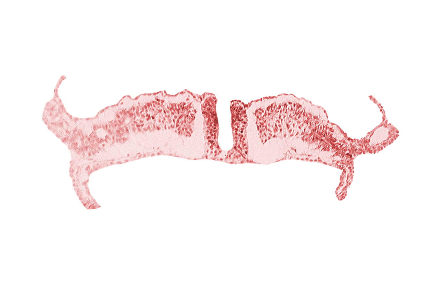 endoderm, intermediate mesenchyme, paraxial mesoderm, primordial peritoneal cavity, somatopleuric mesoderm, splanchnopleuric mesoderm, surface ectoderm