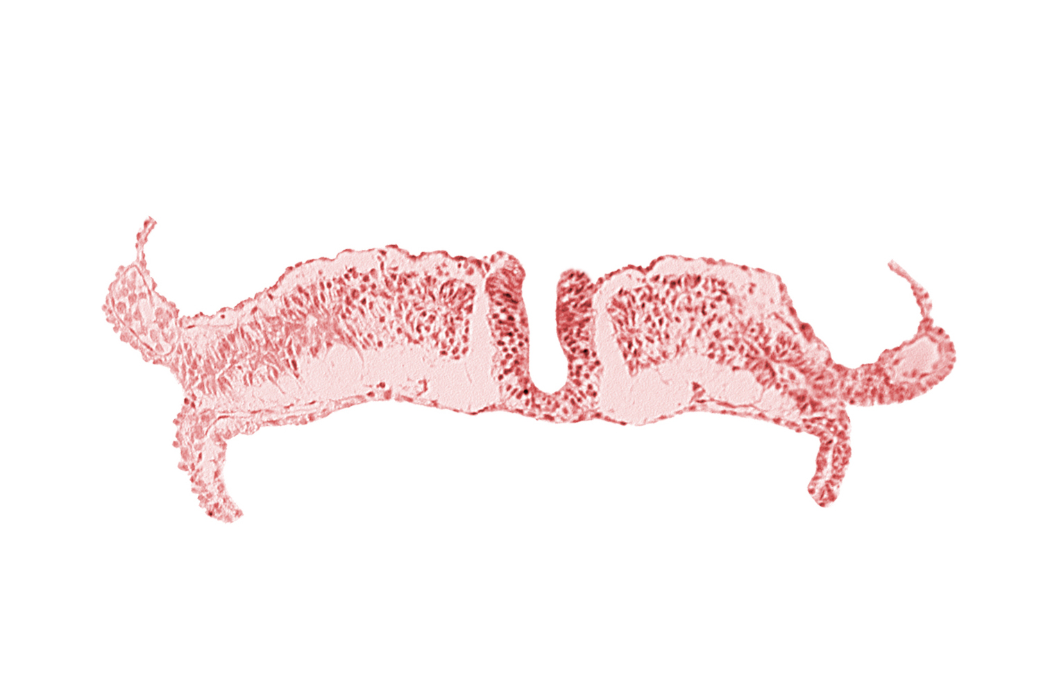 endoderm, intermediate mesenchyme, paraxial mesoderm, splanchnopleuric mesoderm, surface ectoderm