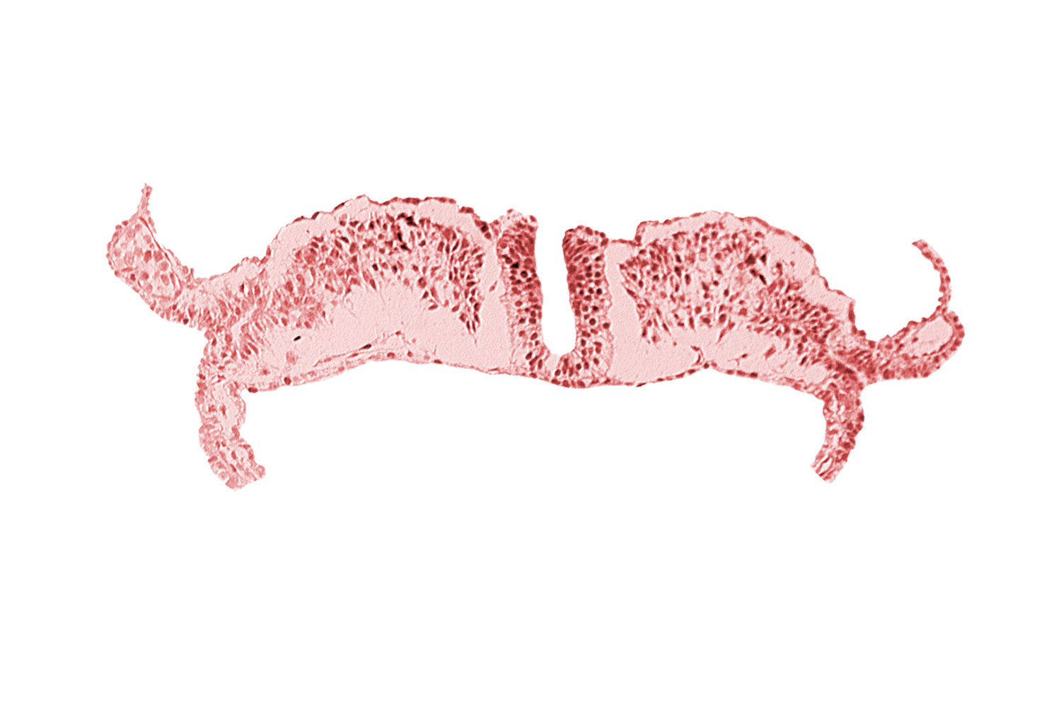 amniotic cavity, caudal neuropore, communication between primordial peritoneal cavity and extra-embryonic coelom, dorsal aorta plexus, umbilical vesicle cavity