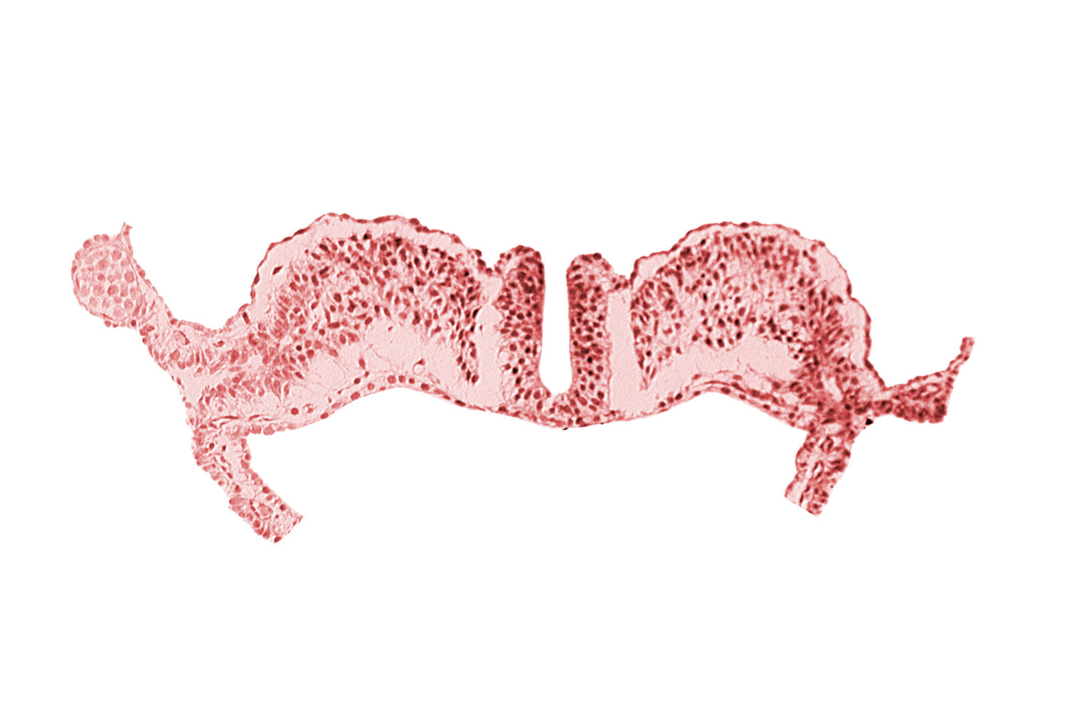 amniotic cavity, communication between primordial peritoneal cavity and extra-embryonic coelom, dorsal aorta plexus, midgut, notochordal plate