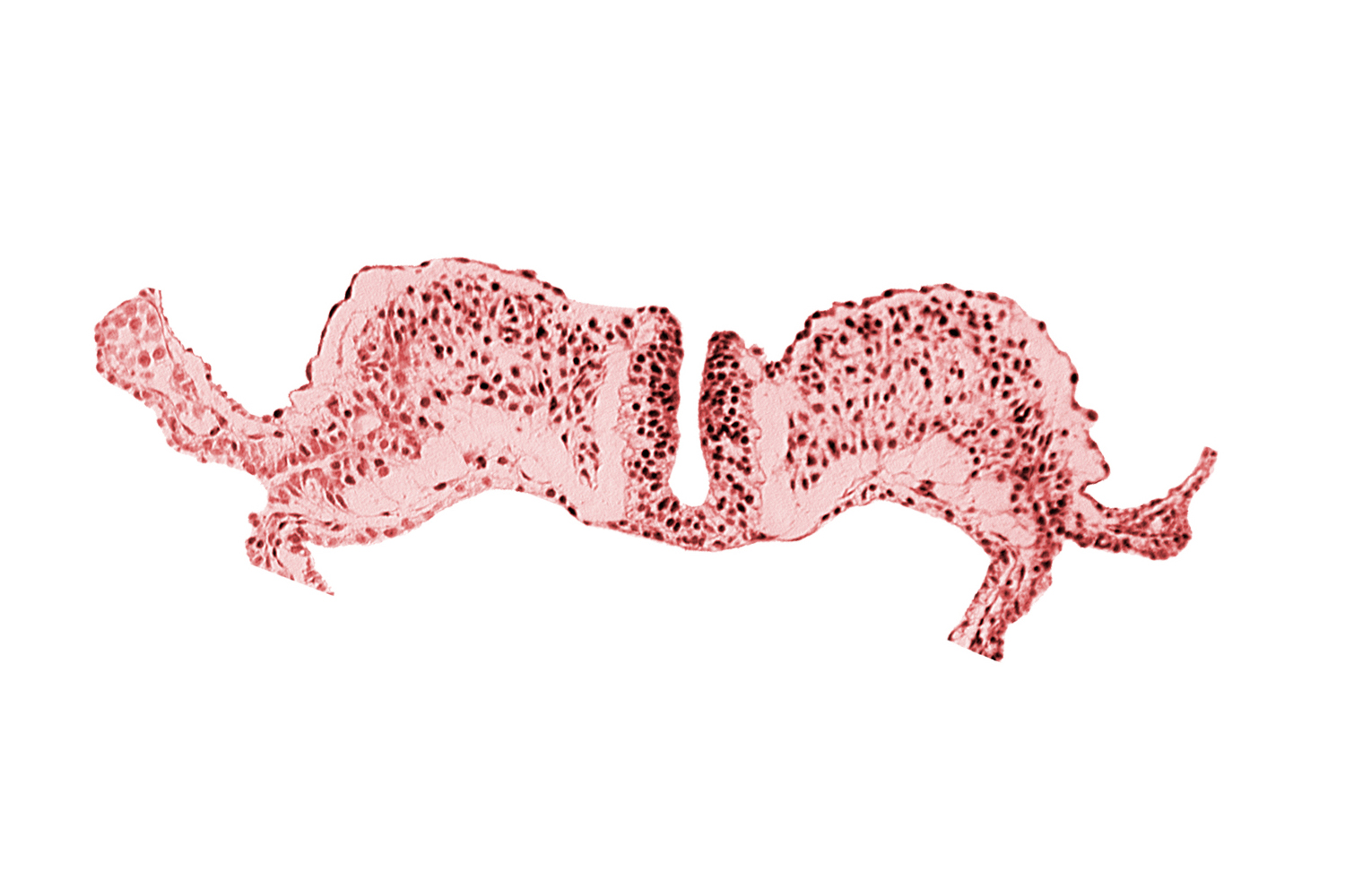 endoderm, neural fold, notochordal plate, primordial lateral body fold, surface ectoderm