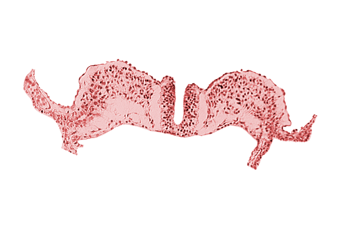 caudal neuropore, dorsal aorta plexus, midgut, primordial lateral body fold, surface ectoderm