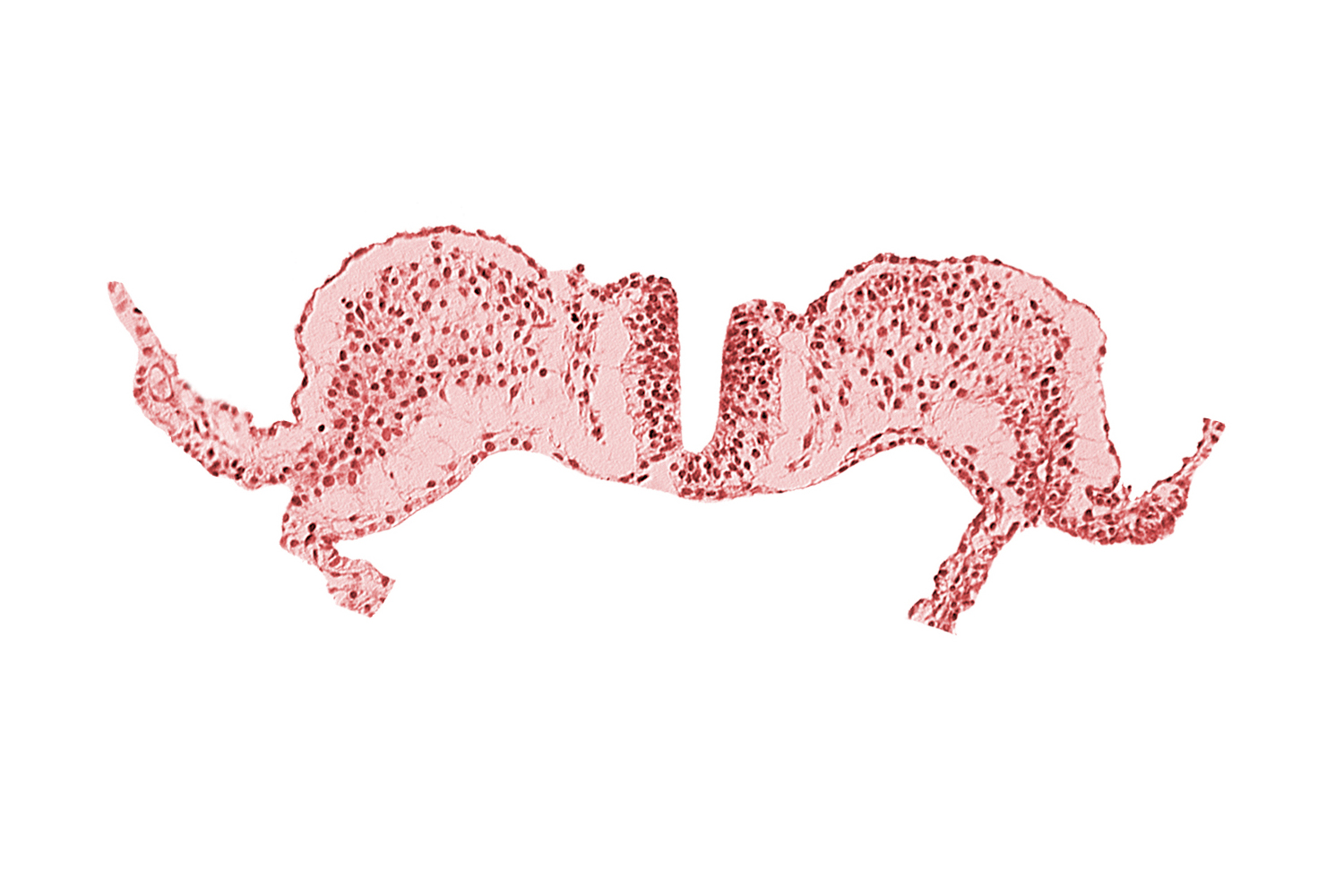 caudal neuropore, communication between primordial peritoneal cavity and extra-embryonic coelom, primordial lateral body fold