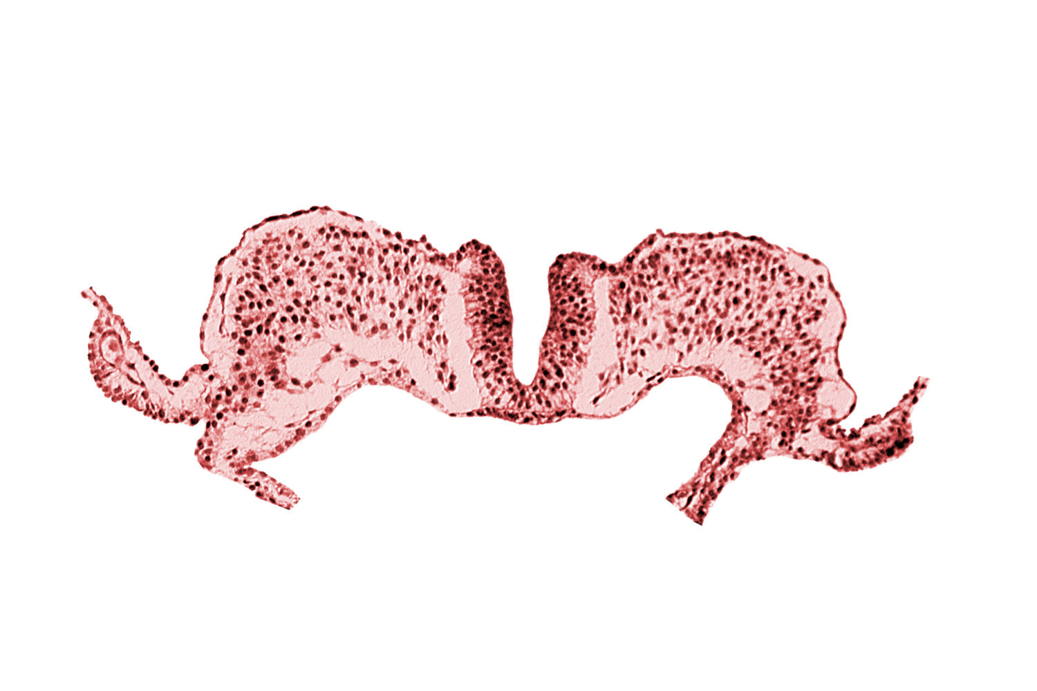 amnion attachment, amniotic cavity, midgut, primordial lateral body fold, umbilical vesicle cavity