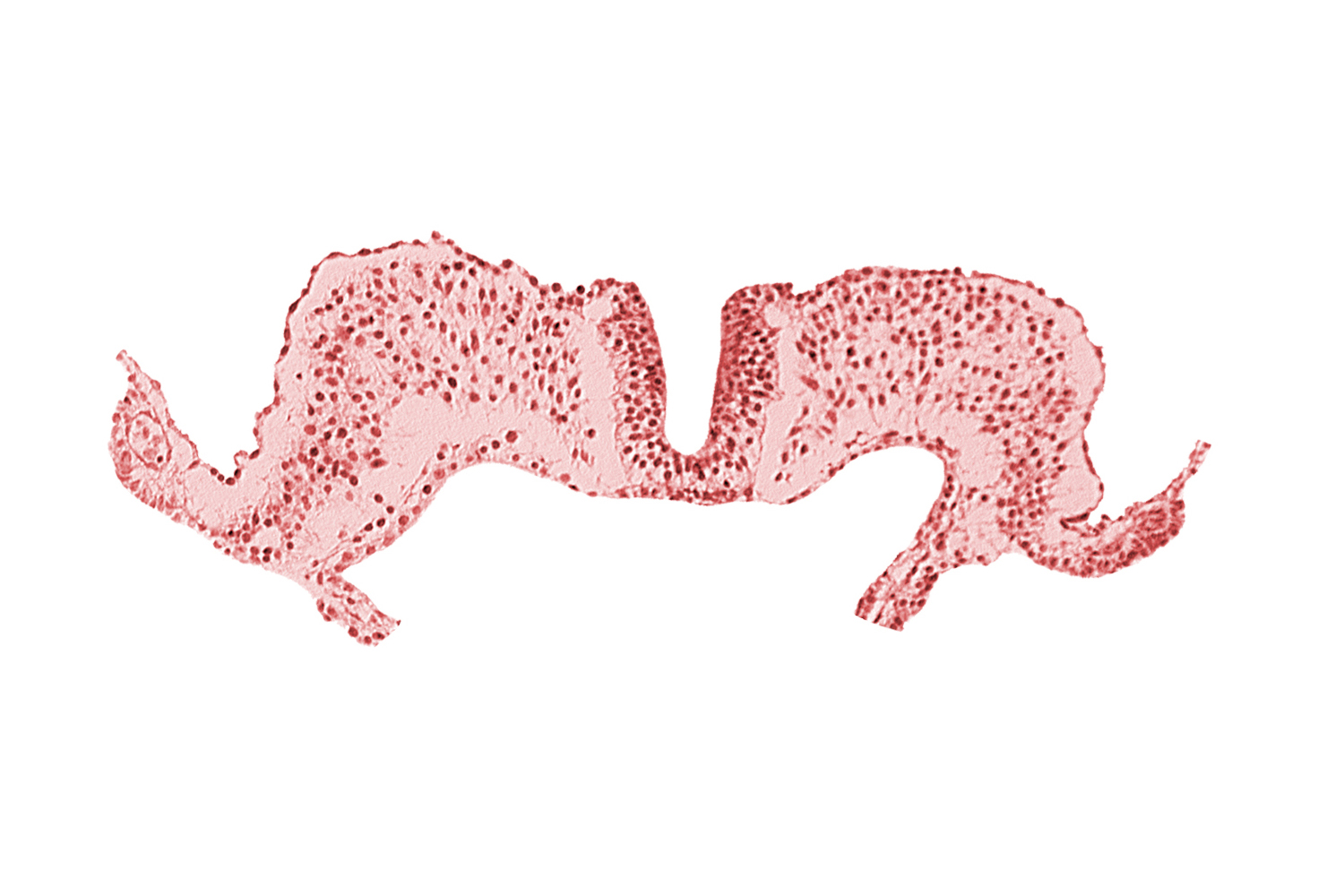 amnion attachment, amniotic cavity, caudal neuropore, primordial lateral body fold, umbilical vesicle cavity