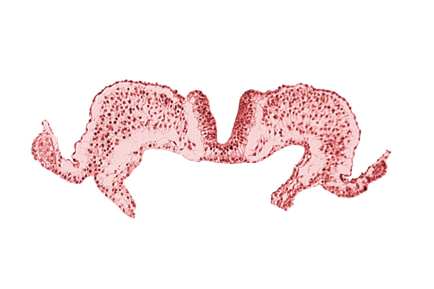 amniotic cavity, caudal neuropore, primordial lateral body fold