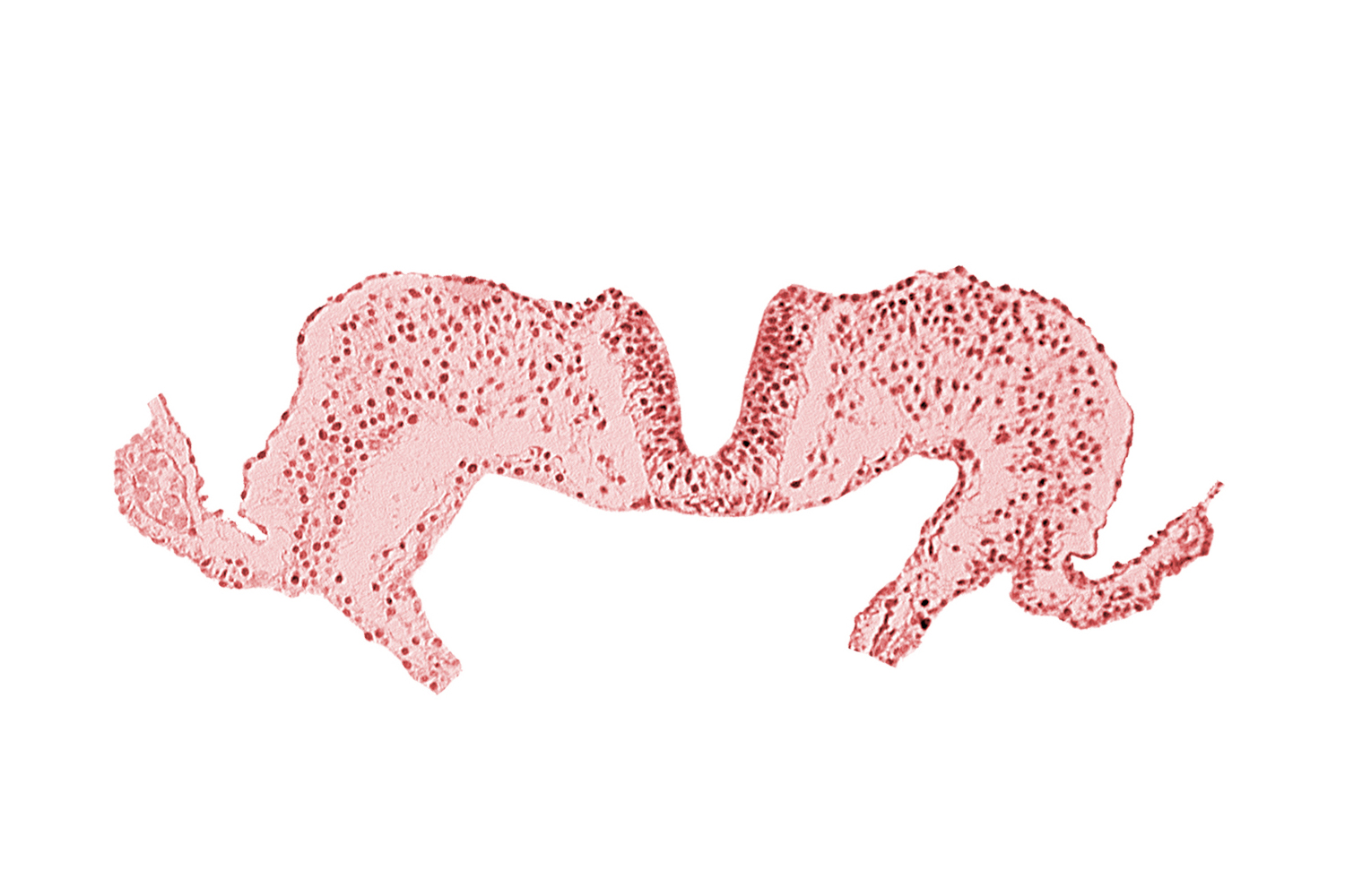 amniotic cavity, caudal neuropore, midgut, notochordal plate, primordial lateral body fold
