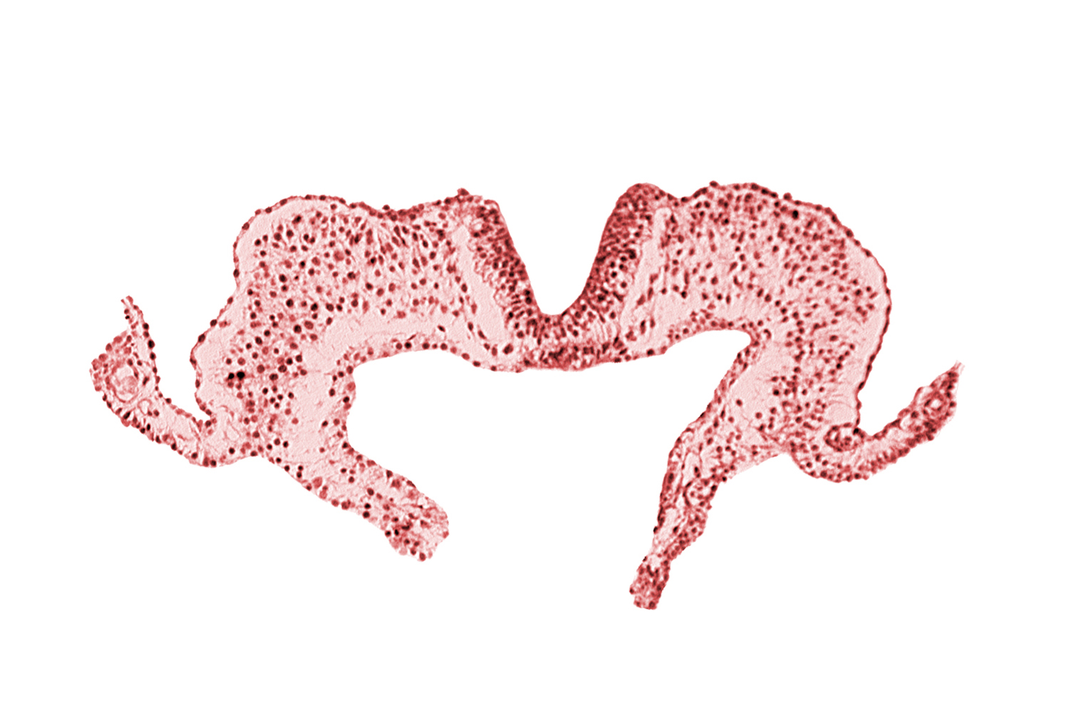 caudal neuropore, midgut, notochordal plate, primordial lateral body fold, surface ectoderm