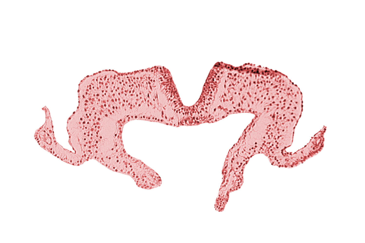 endoderm, mesoderm, midgut, neural fold, neural groove, notochordal plate, primordial lateral body fold, surface ectoderm