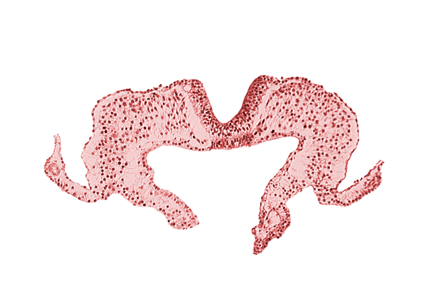 caudal part of notochordal plate, mesoderm, neural fold, neural groove, primordial lateral body fold, surface ectoderm