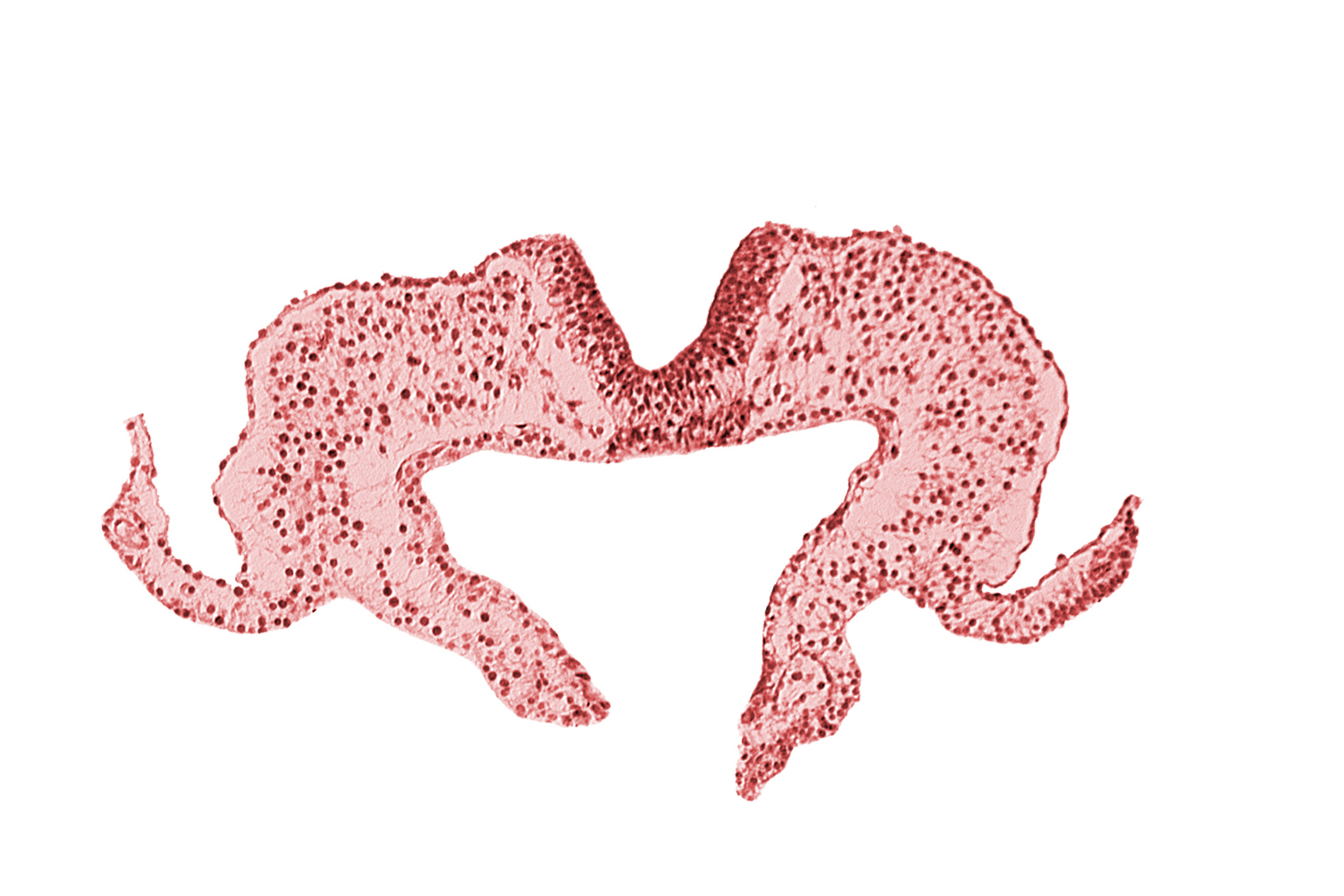 caudal edge of notochordal plate, mesoderm, midgut, neural fold, neural groove, primordial lateral body fold, surface ectoderm