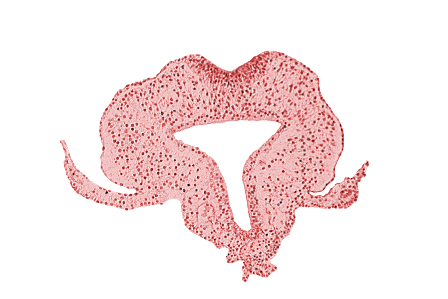 allantoic primordium, amnion attachment, amniotic cavity, extra-embryonic coelom, gastrulation (primitive) streak, hindgut, left umbilical vein, neural plate, primordial lateral body fold