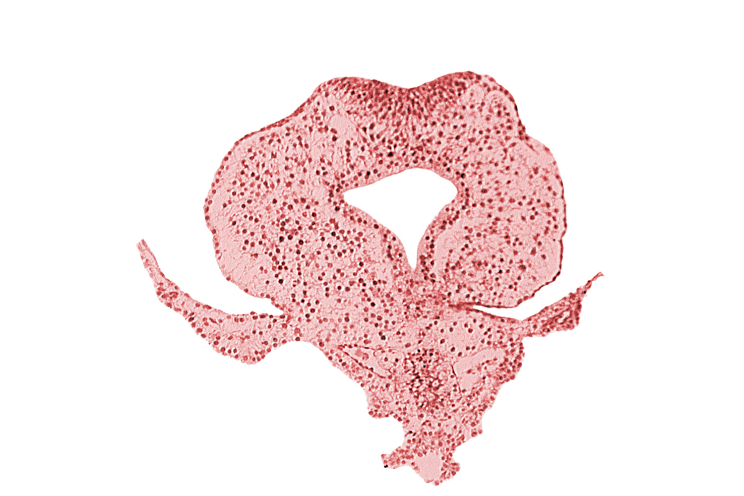 allantoic primordium, amnion attachment, body stalk, caudal eminence, cloacal membrane, gastrulation (primitive) streak, hindgut, junction of amnion and tail fold, left umbilical vein, neural plate, tail fold region
