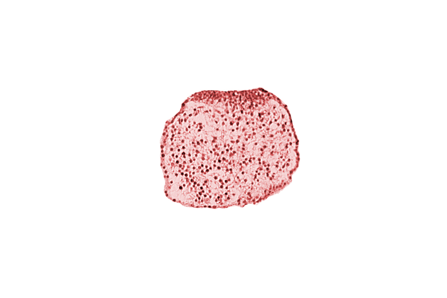 caudal eminence, gastrulation (primitive) streak, neural ectoderm, surface ectoderm of caudal eminence