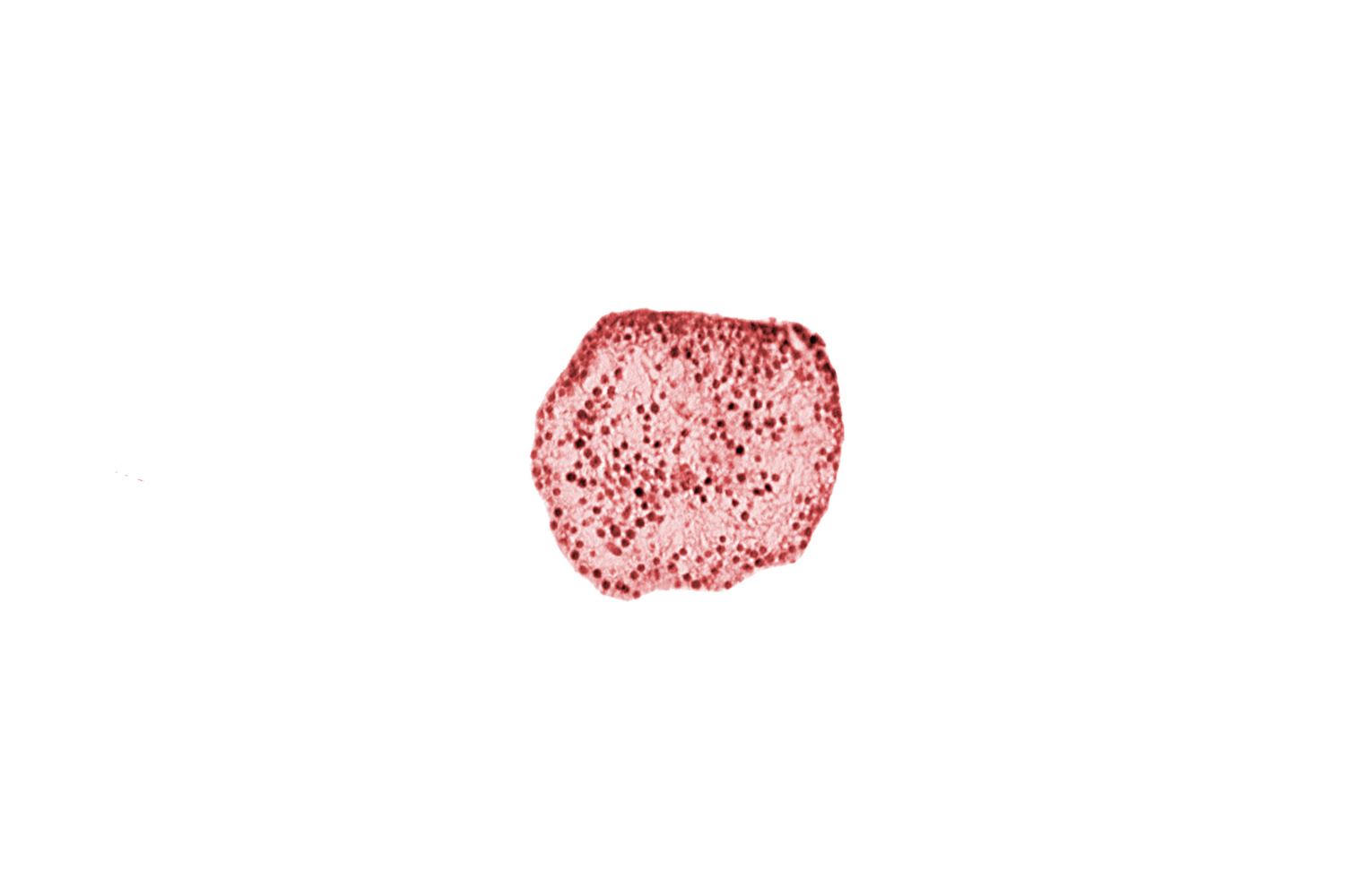 caudal part of caudal eminence, caudal part of neural cord