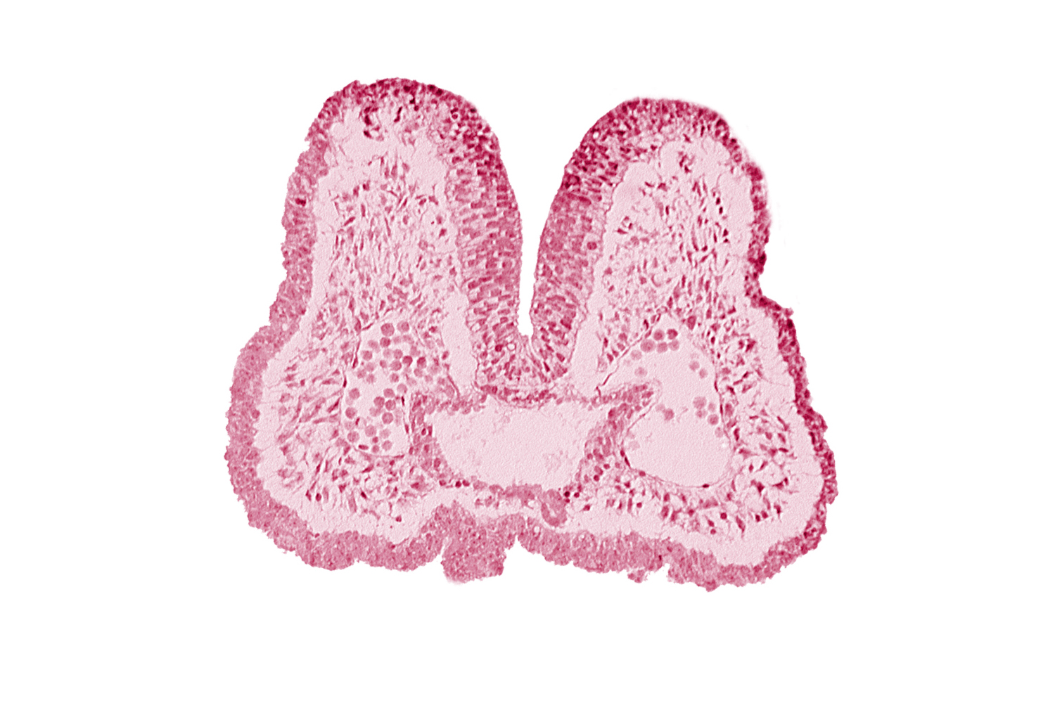 aortic arch 1, artifact space(s), cephalic edge of pharyngeal pouch 1, endoderm, foregut, mandibular prominence of pharyngeal arch 1, mesencephalic neural crest, neural fold [mesencephalon (M)], stomodeum