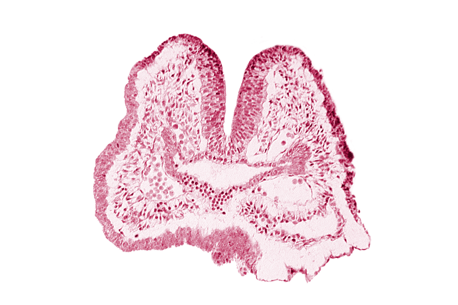 aortic arch 1, cephalic neuropore, dorsal aorta, endoderm, facio-vestibulocochlear neural crest (CN VII and CN VIII), floor of foregut, foregut, neural fold [rhombencephalon (Rh. A)], notochordal plate, pericardial cavity, pharyngeal pouch 1, surface ectoderm