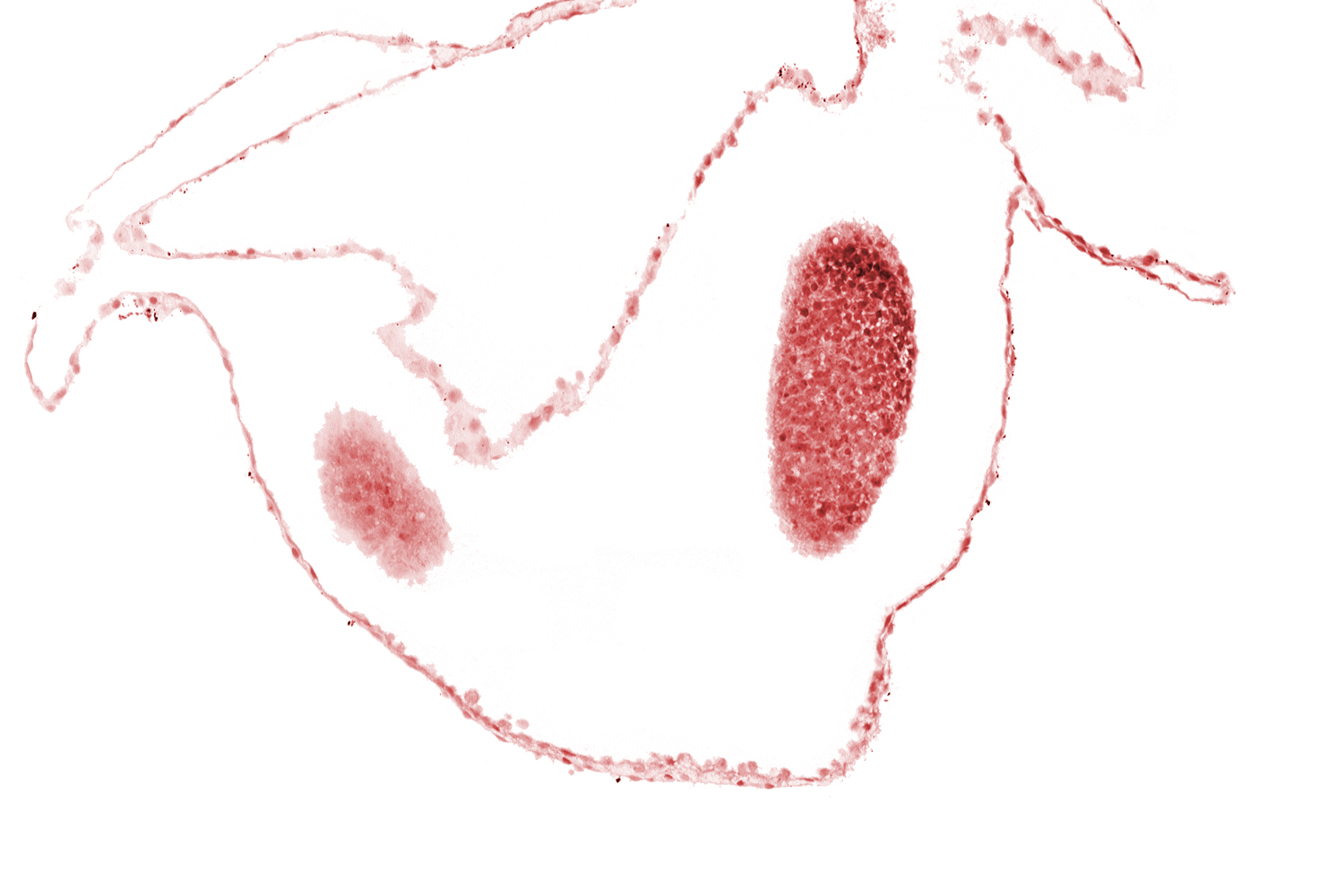 cephalic edge of left neural fold (primordial diencephalon), cephalic part of left neural fold (primordial diencephalon)