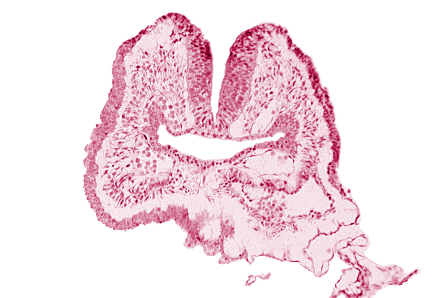 amnion, aortic arch 1, cephalic neuropore, dorsal aorta, endoderm, facio-vestibulocochlear neural crest (CN VII and CN VIII), floor of foregut, head fold region, neural fold [rhombencephalon (Rh. A)], pericardial cavity, pharyngeal pouch 1, surface ectoderm