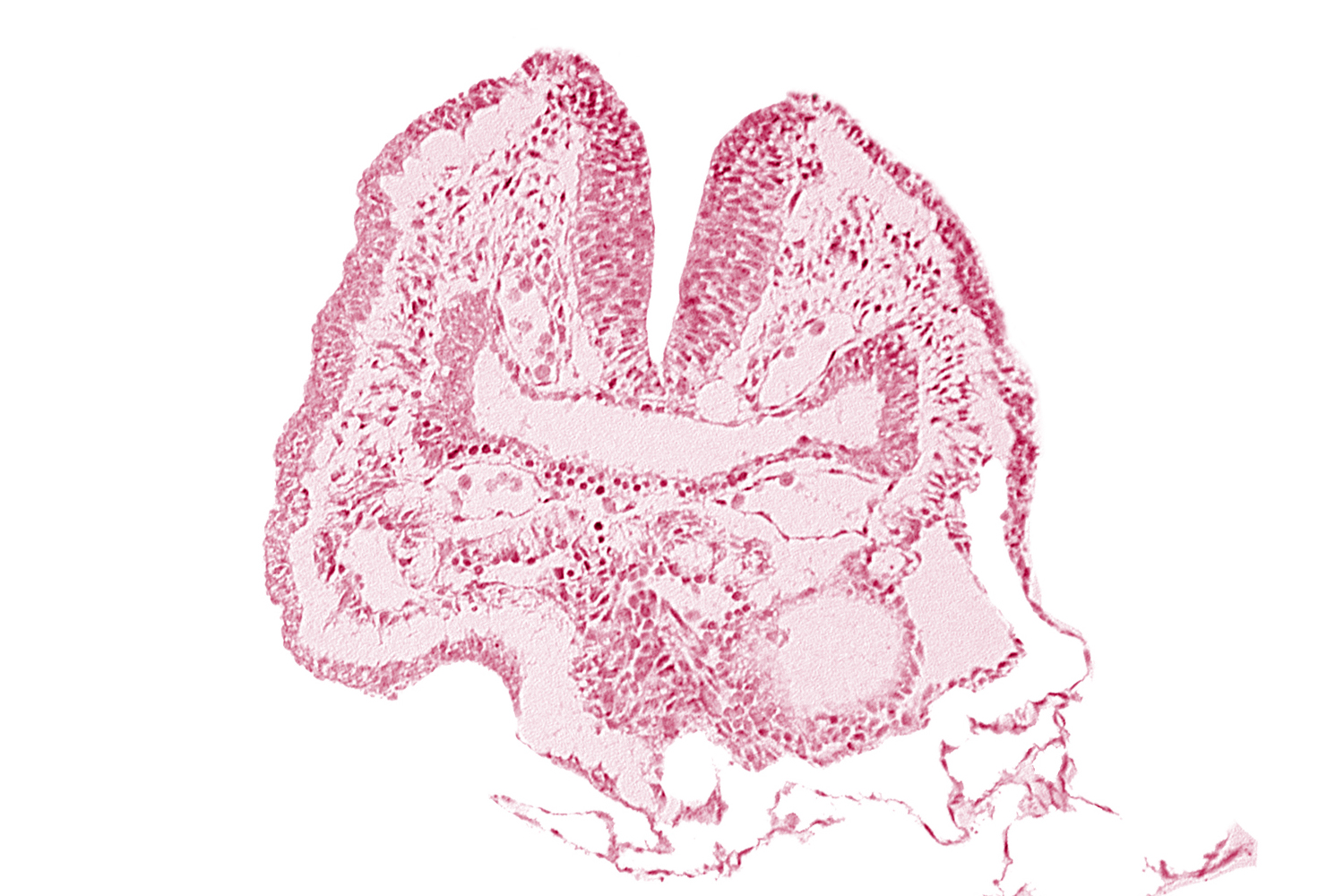 amnion, aortic arch 1, cephalic neuropore, dorsal aorta, facio-vestibulocochlear neural crest (CN VII and CN VIII), head fold region, neural fold [rhombencephalon (Rh. A)], pericardial cavity, pharyngeal pouch 1, pharyngeal pouch 1 endoderm: dorsal part, pharyngeal pouch 1 endoderm: ventral part