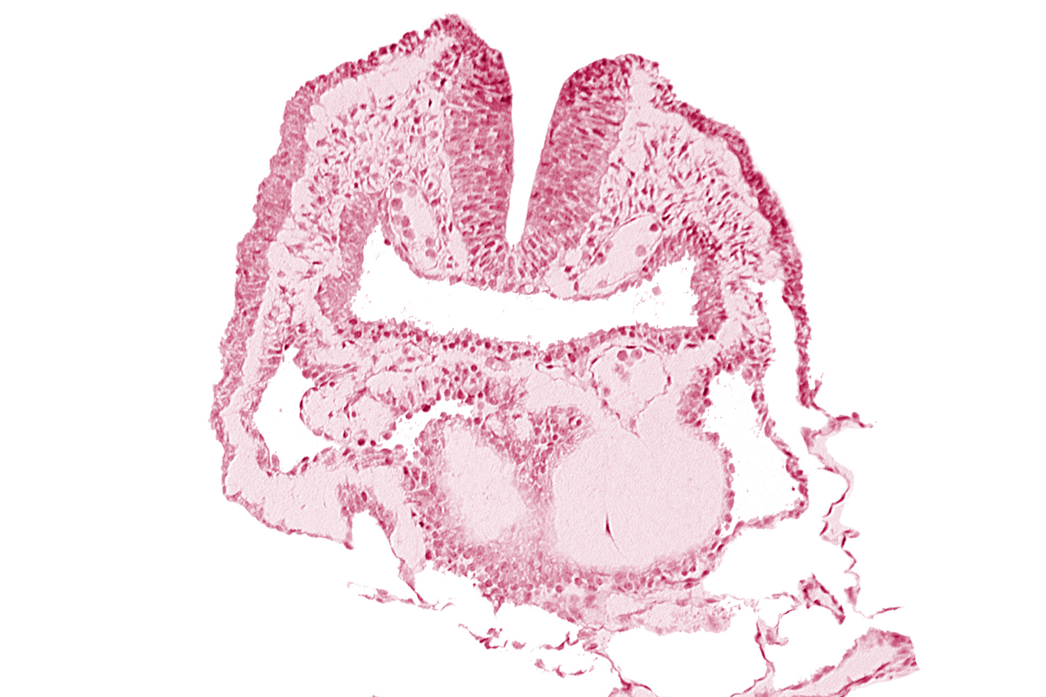 amnion, aortic arch 1, dorsal aorta, head fold region, neural fold [rhombencephalon (Rh. A)], pericardial cavity, pharyngeal pouch 1