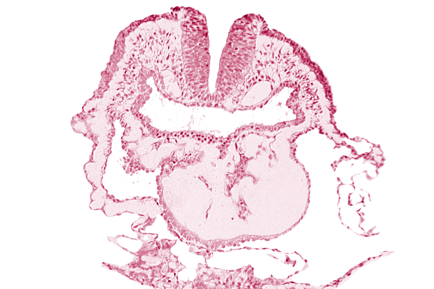 aortic arch 1, cephalic neuropore, conotruncus, dorsal aorta, head fold region, head mesenchyme, neural fold [rhombencephalon (Rh. A)], pericardial cavity, pharyngeal pouch 1, pharyngeal pouch 1 endoderm: dorsal part, pharyngeal pouch 1 endoderm: ventral part