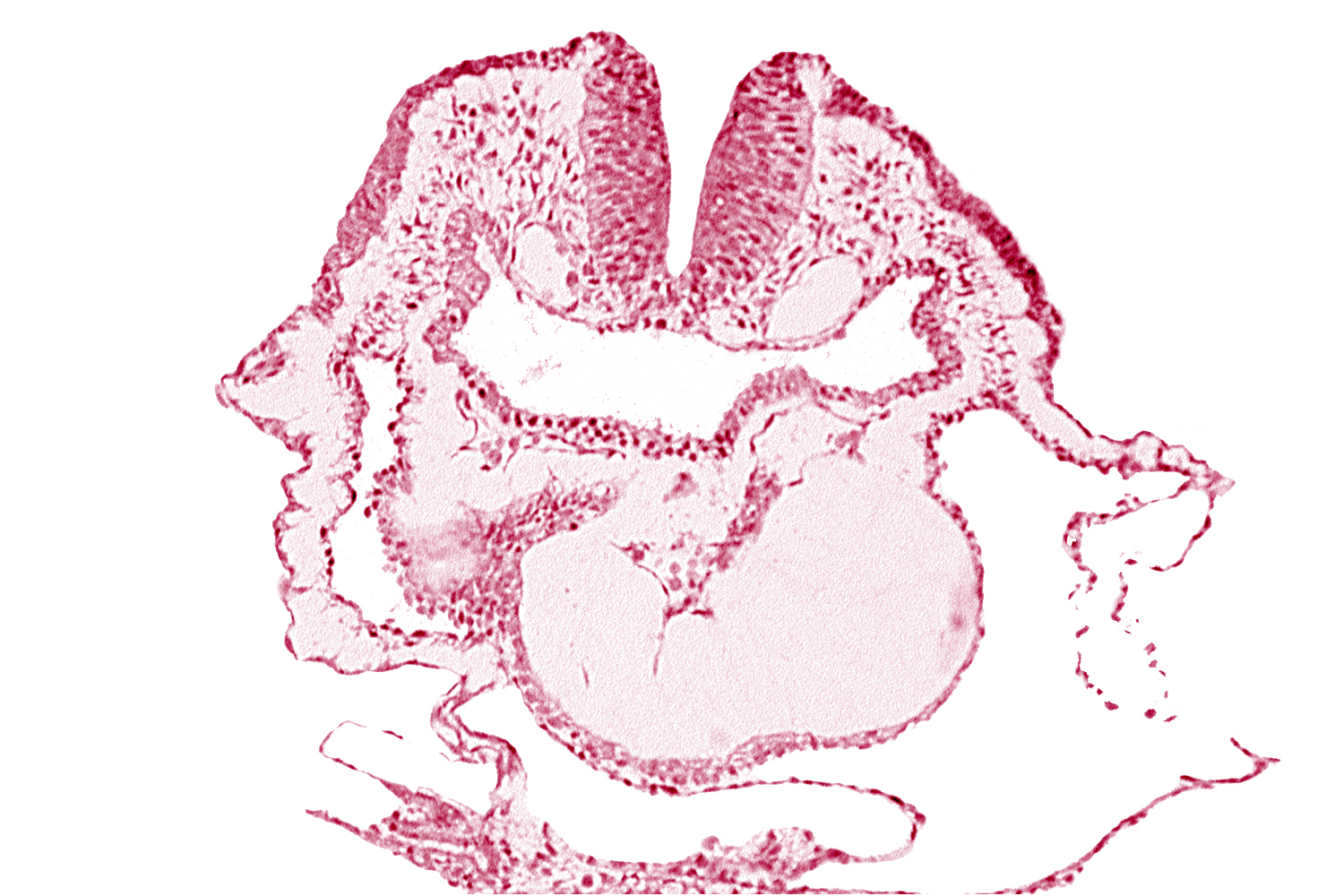 aortic arch 1, cardiac jelly, conotruncus, dorsal aorta, endocardium, head mesenchyme, junction of aortic arch 1 and primordial conotruncus, neural fold [rhombencephalon (Rh. A)], pericardial cavity