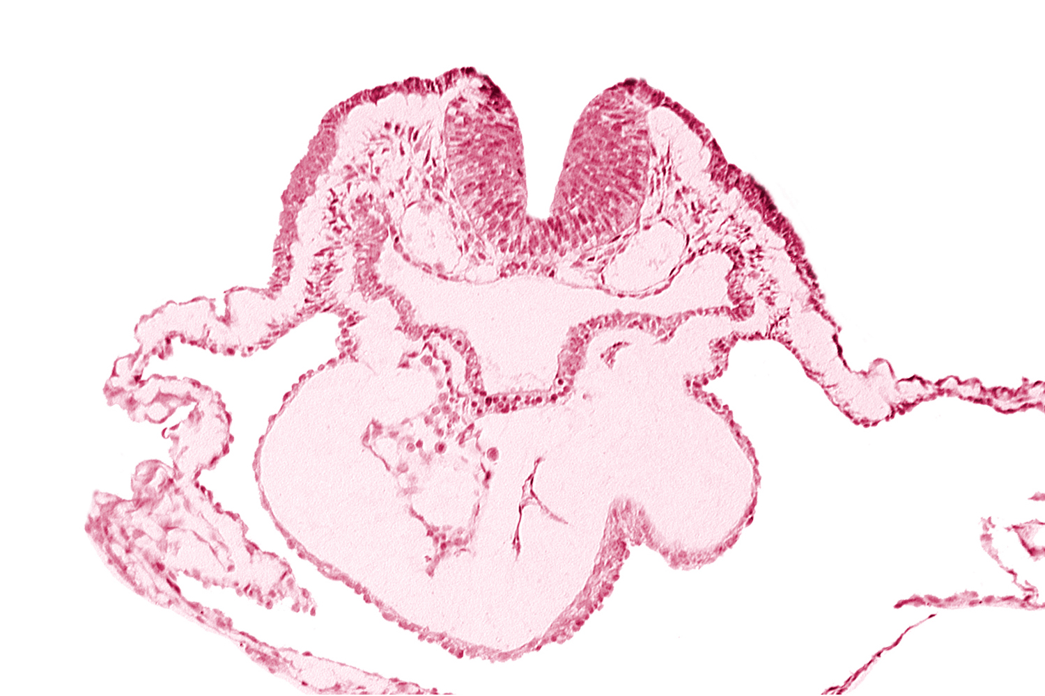 artifact separation(s), bulbis cordis, dorsal aorta, lateral pharyngeal recess, left bulboventricular sulcus, neural fold [rhombencephalon (Rh. B)], notochordal plate, pericardial cavity