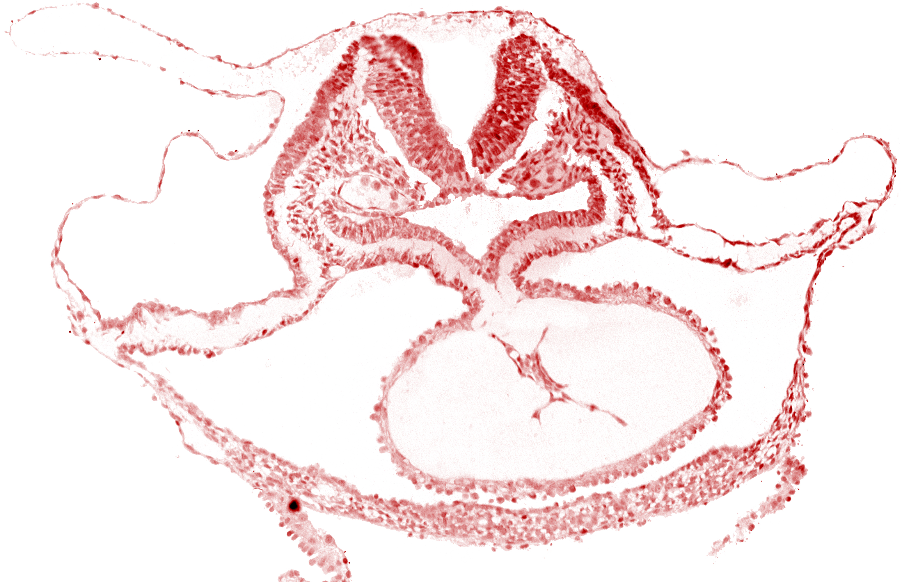 cardiac jelly, dorsal aorta, laryngotracheal sulcus, mesocardium, neural fold [rhombencephalon (Rh. C)], otic placode, pericardial cavity, presumptive left ventricle, respiratory primordium
