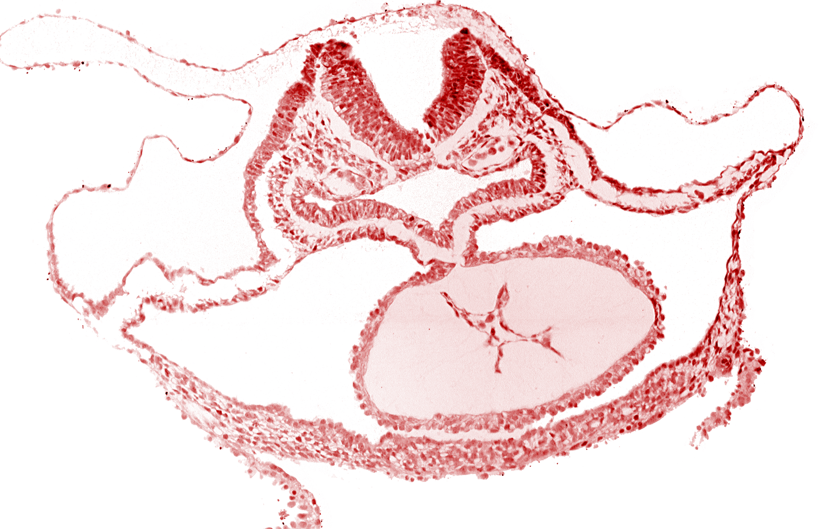 foregut endoderm, foregut lumen, laryngotracheal sulcus, neural fold [rhombencephalon (Rh. C)], otic placode, presumptive left ventricle, respiratory primordium